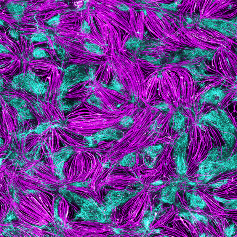 The image shows a 2D model of neuromuscular junctions. A special fluorescence technique makes the structures visible in magenta and cyan. The tissue looks like many interwoven threads.