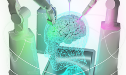 Animation of a human brain being treated by AI-controlled robotic arms.