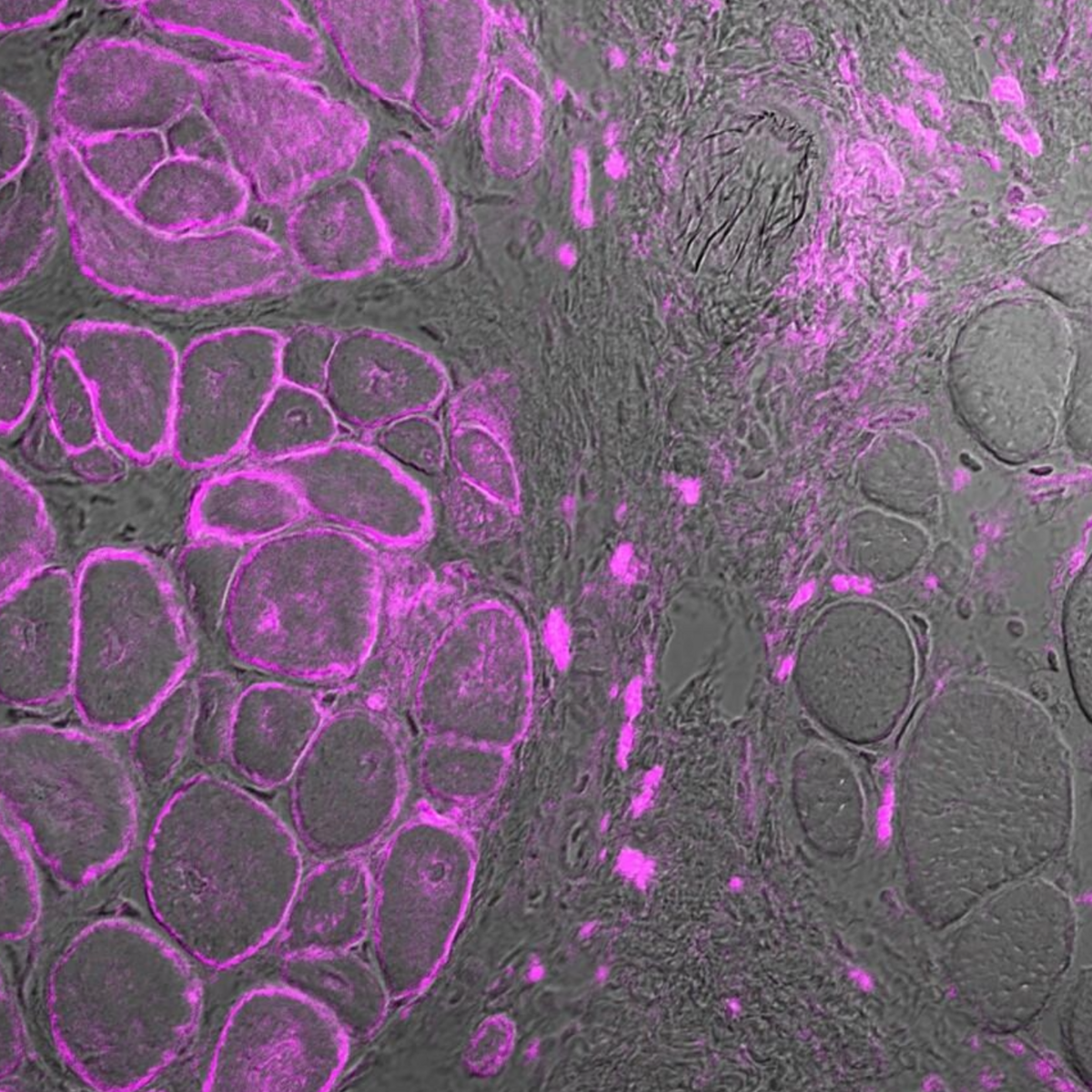 Microscopic image of a stem cell that produces dysferlin again. Color coding.