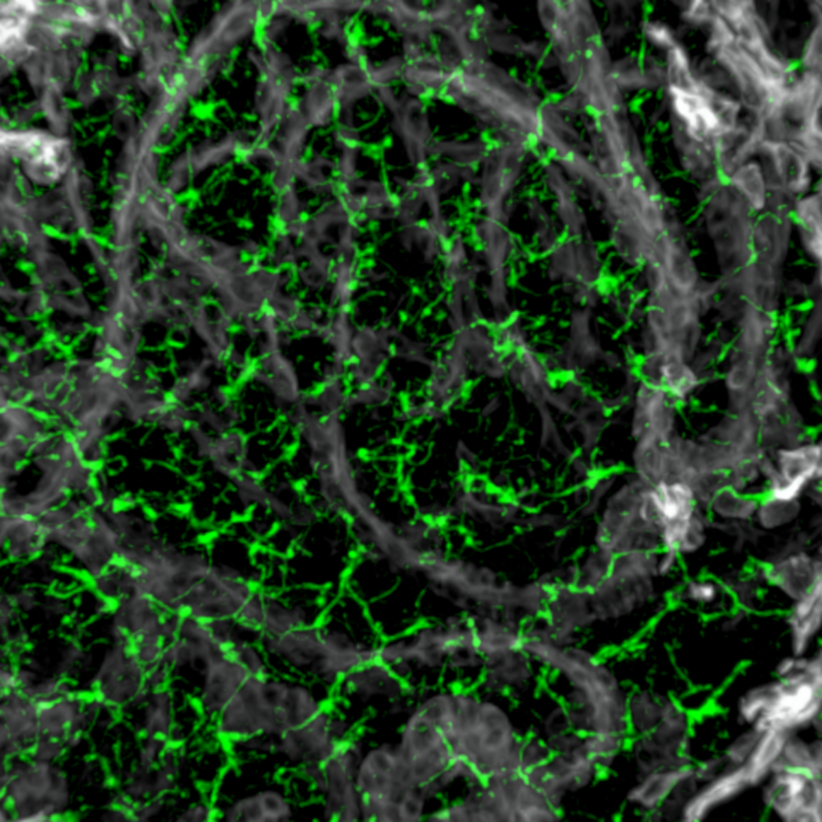Picture shows a liver cell under the microscope