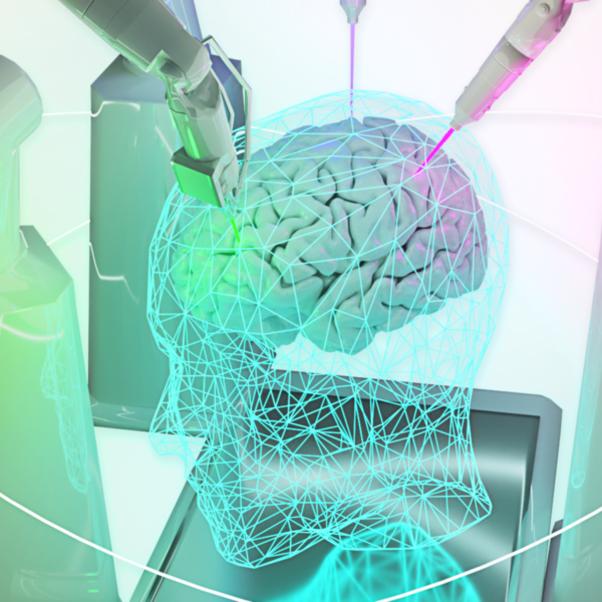 Animation of a human brain being treated by AI-controlled robotic arms.