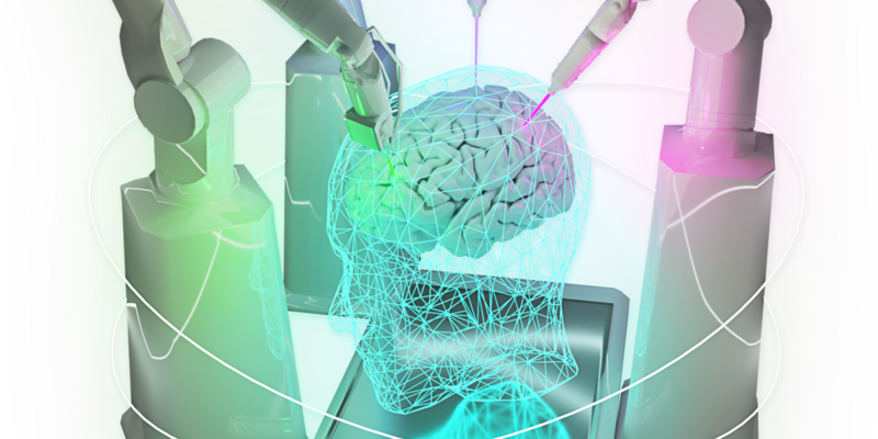 Animation of a human brain being treated by AI-controlled robotic arms.