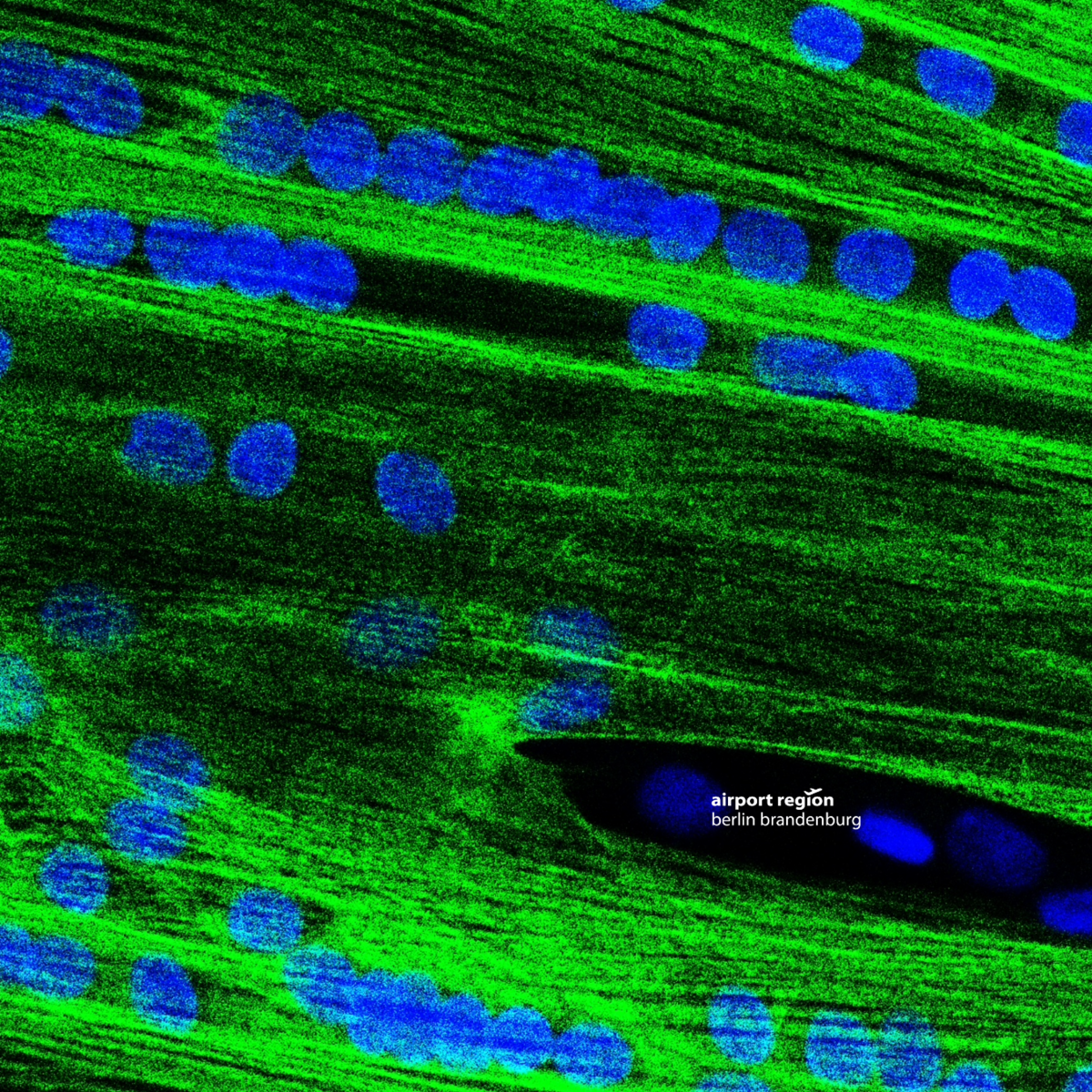 Picture shows a muscle fibre under the microscope.