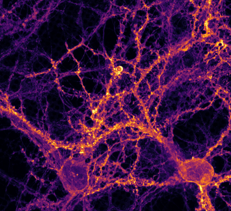 Watching neurons fire — the research team achieved this using an optogenetic technique. The neurons, shown here in purple, release neurotransmitters in response to a light pulse, causing the synapses between them to light up yellow. The team plunge-froze the samples to examine the transmitter release in detail.