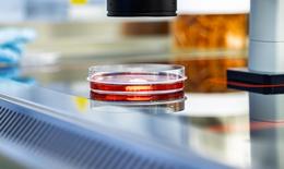 Promotional image for the announcement: The "Center for AI–Accelerated Molecular Innovations in Medicine" is being established at the Max Delbrück Center – Vessels with liquids.